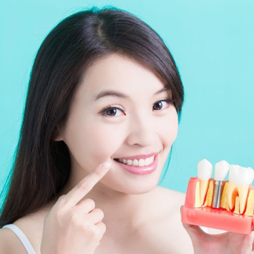 Đối tượng nào phù hợp cấy ghép Implant All On 4?